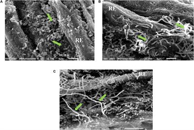 Halotolerant Marine Rhizosphere-Competent Actinobacteria Promote Salicornia bigelovii Growth and Seed Production Using Seawater Irrigation